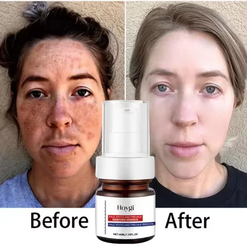 Velvora™ Collagen Lift Duo