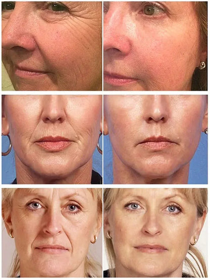 Velvora™ Collagen Lift Duo