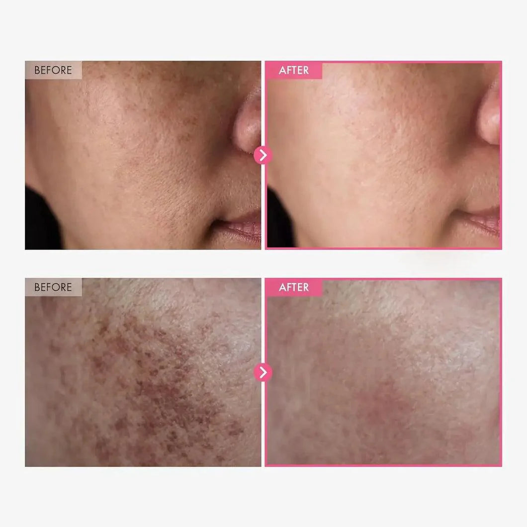 TOSOOWONG Dark Spot 35 Cream