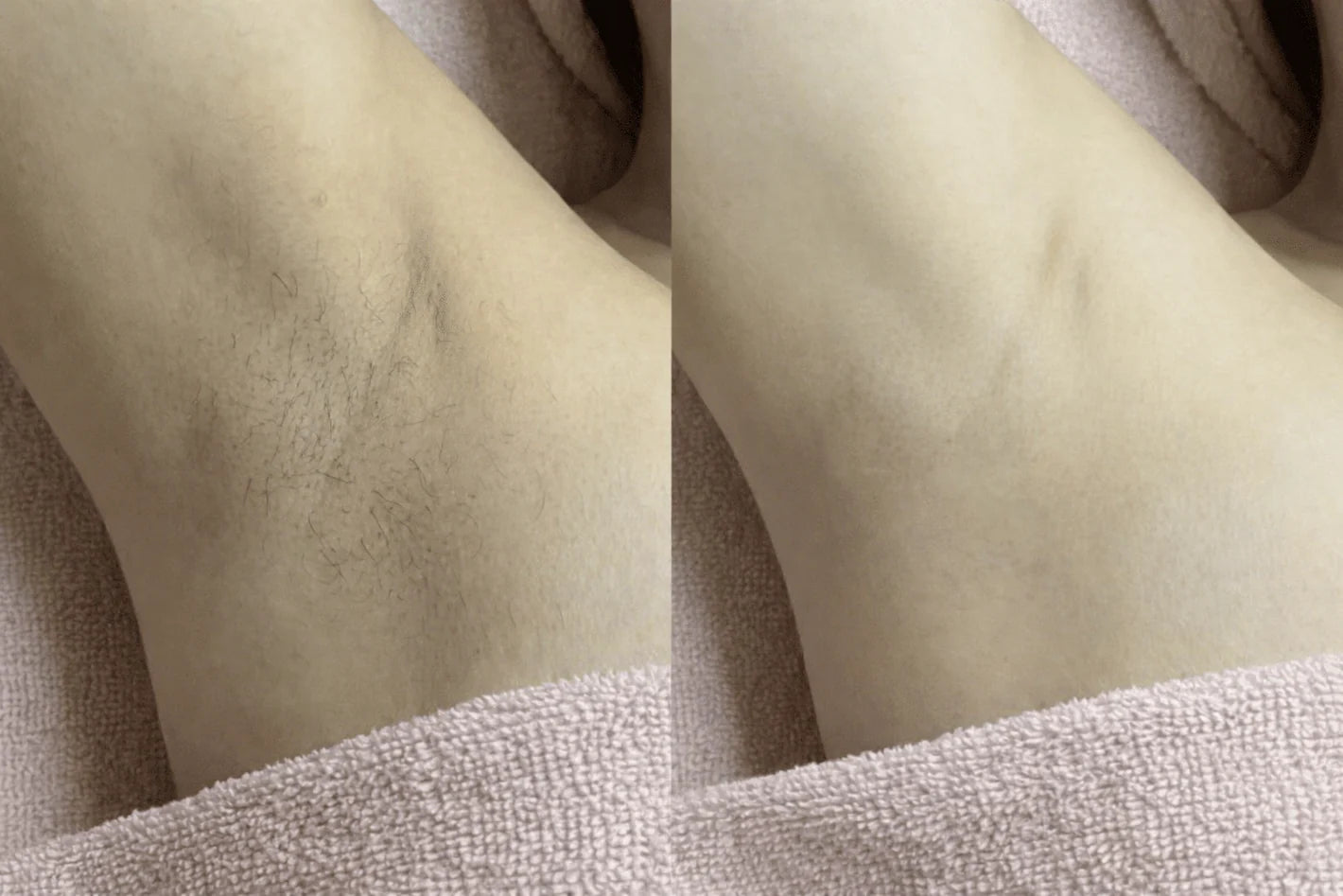 CARAMELA™ Beauty Oil