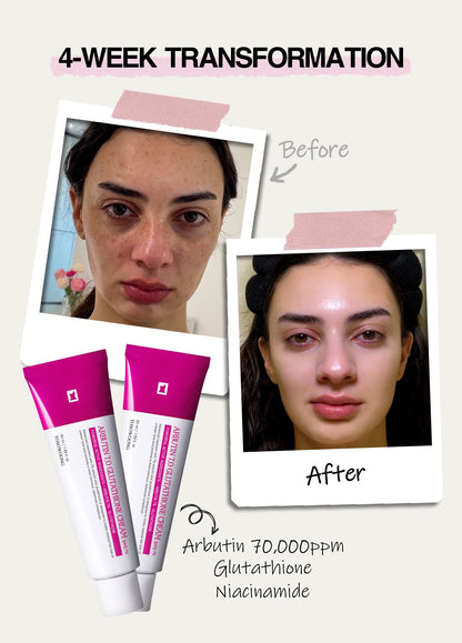 TOSOOWONG Dark Spot 35 Cream