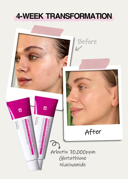 TOSOOWONG Dark Spot 35 Cream