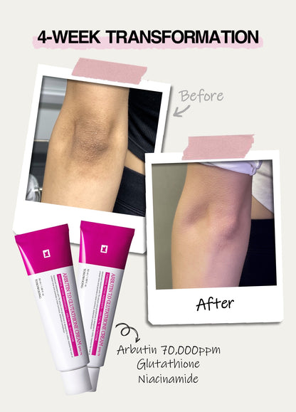 TOSOOWONG Dark Spot 35 Cream